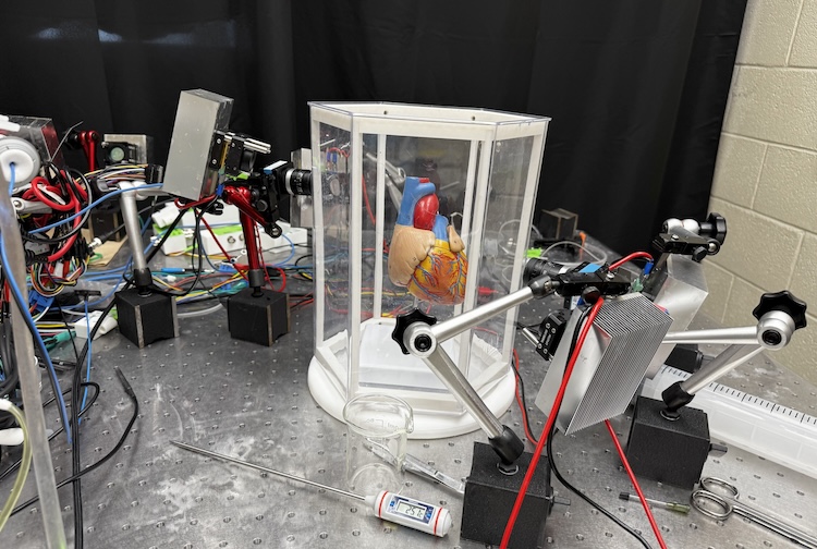 심박조율기 배치 시스템 모델