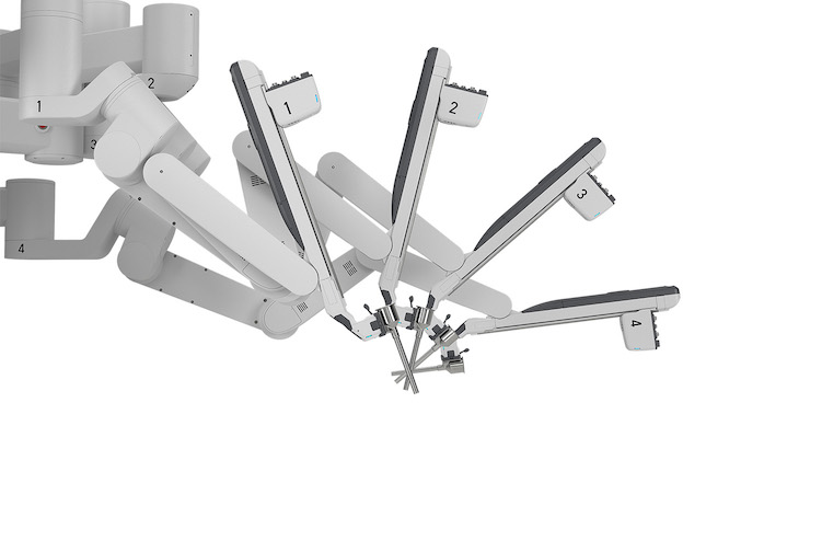 Da Vinci Xl 로봇 팔 4개 사진