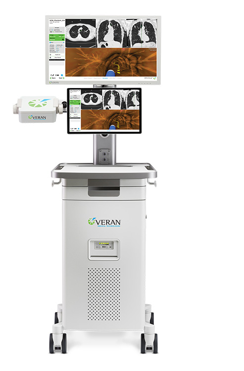 Veran Medical의 폐암용 차세대 ENB SPiN 흉부 네비게이션 시스템